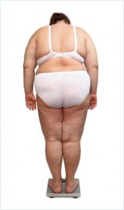 En fedmeoperation behøver ikke være svaret på dit vægt problem